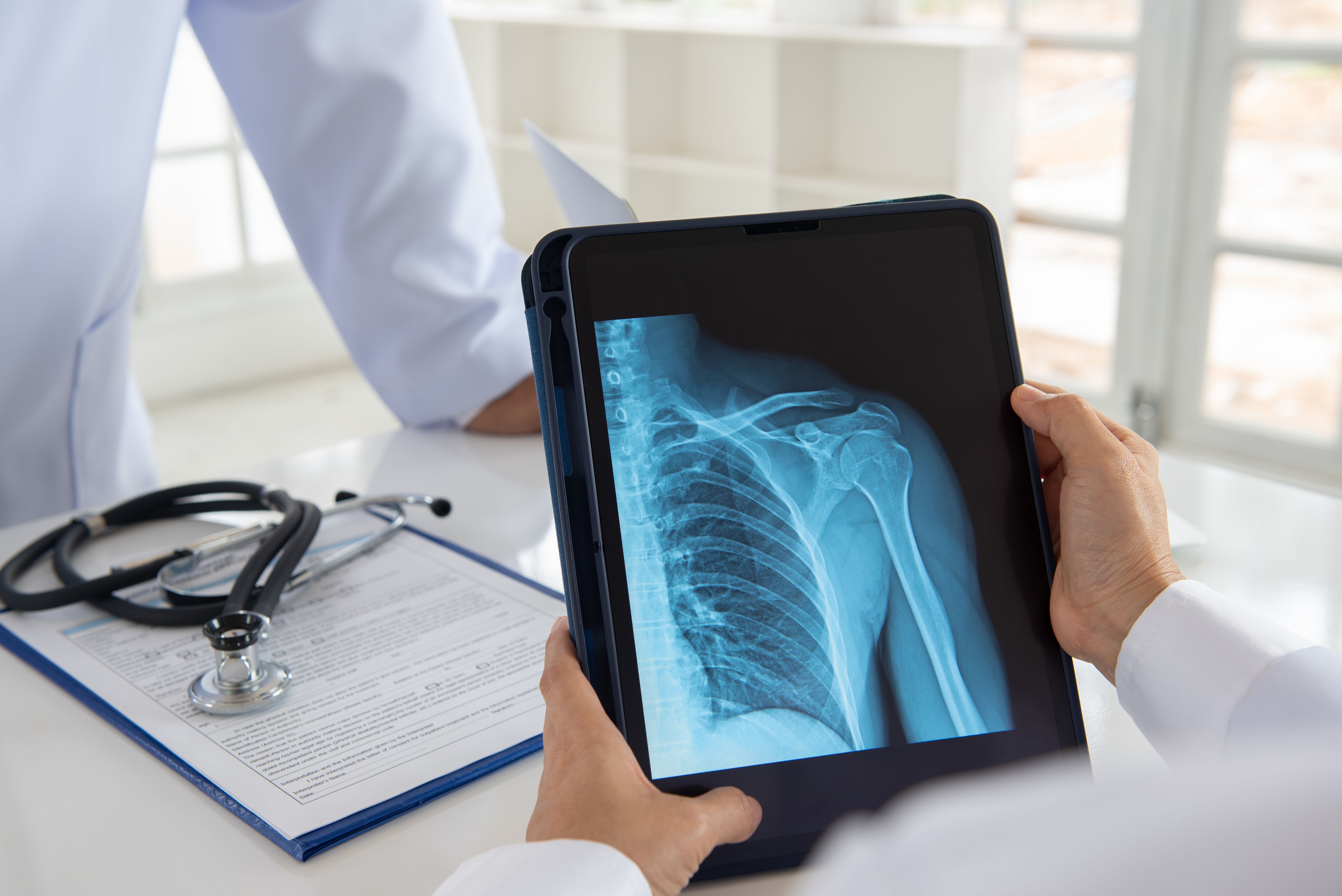 Ein Arzt hält ein Tablet in der Hand, auf dem ein Röntgenbild zu sehen ist.