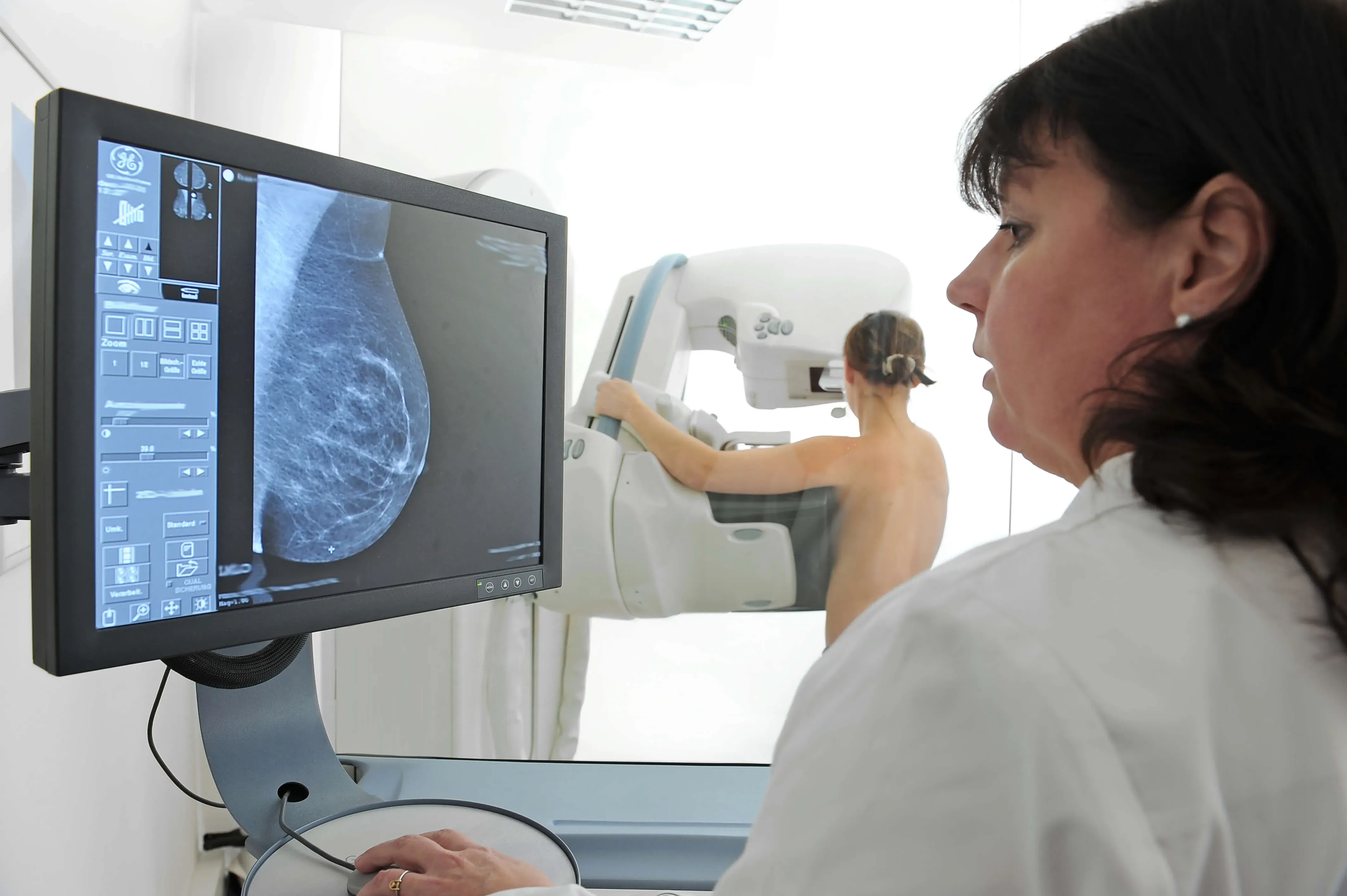 Patientin bei der Mammographie-Untersuchung.
